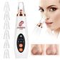 Blackhead Remover Pore Vacuum - JOREEN PLUS (Update)Electric Blackhead Remover Tool Acne Extractor Facial Cleansing Tool Kit,Sui