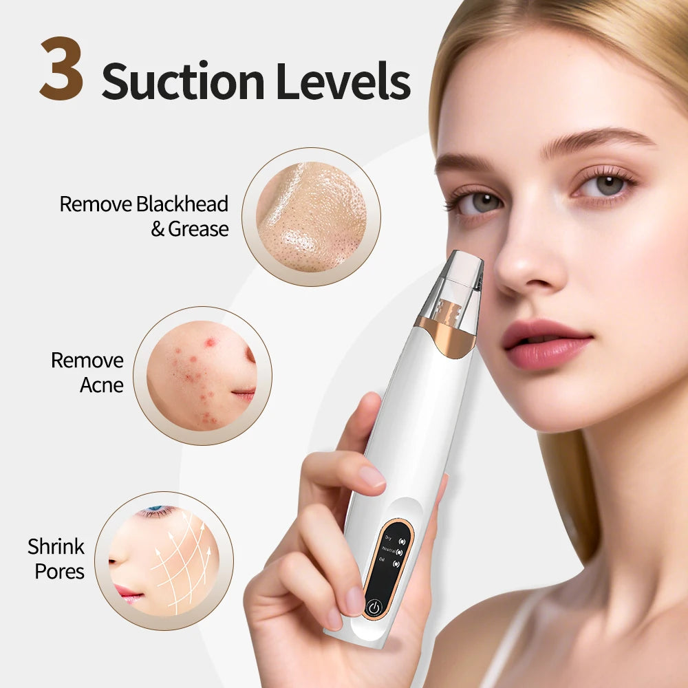 Blackhead Remover Facial Pore Cleaner 3 Suction Power Electric Pimple Acne Extractor Tool Face & Nose Whiteheads Vacuum Removal