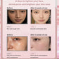 Facial Steamer Nano Ionic Face Hydrating Steam Sprayer Warm Mist Steamer or Home Sauna SPA Humidifier Machine Deep Hydration