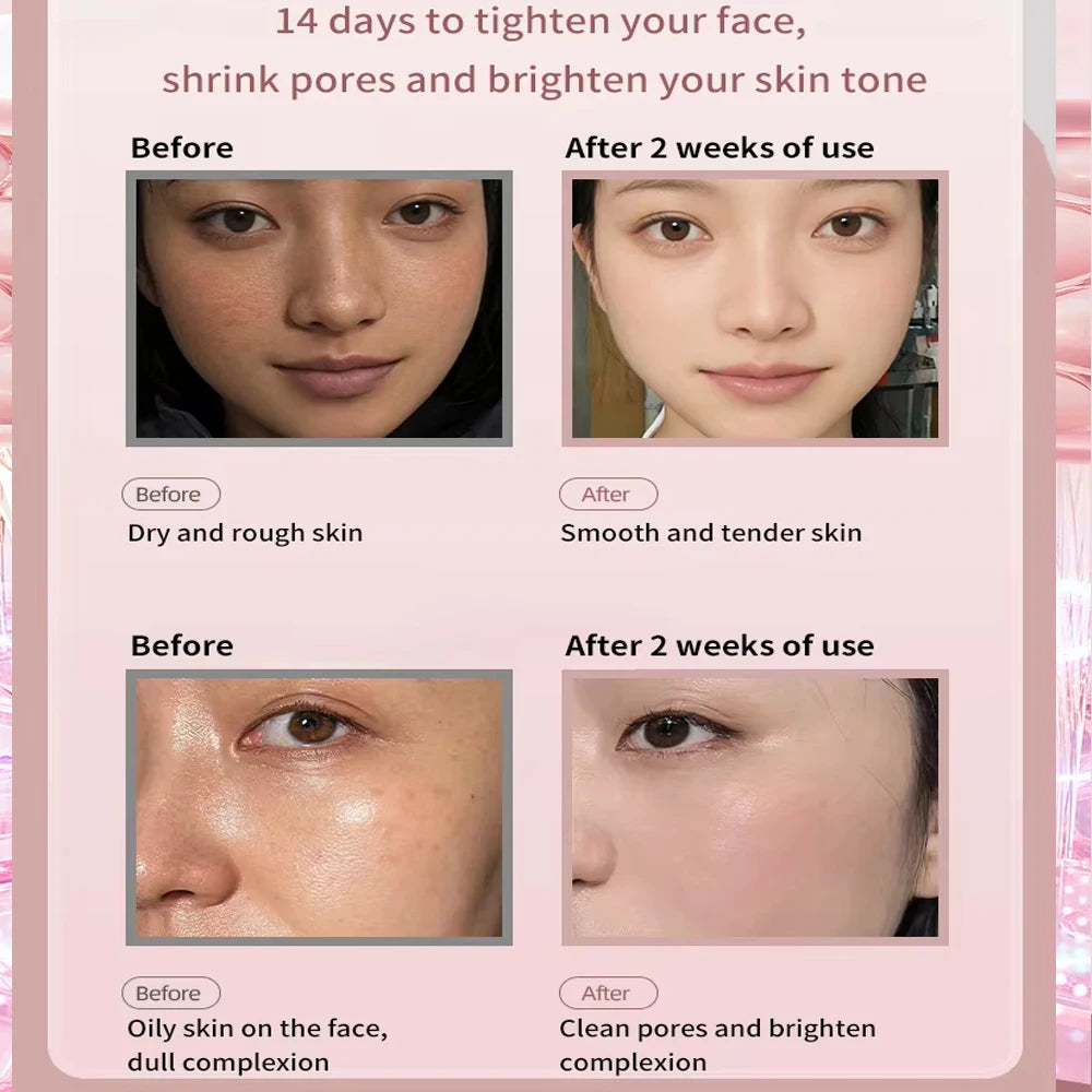 Facial Steamer Nano Ionic Face Hydrating Steam Sprayer Warm Mist Steamer or Home Sauna SPA Humidifier Machine Deep Hydration