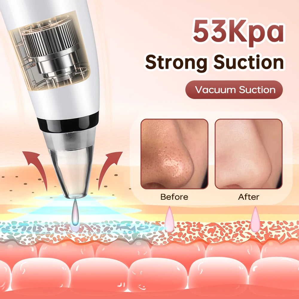 Blackhead Remover Facial Pore Cleaner 3 Suction Power Electric Pimple Acne Extractor Tool Face & Nose Whiteheads Vacuum Removal