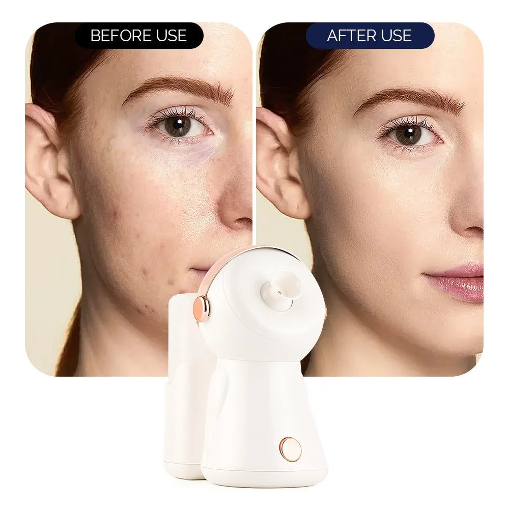 380ml Face Steamer Nano Spray Ionic Nebulizer Facial Vaporizer Hot Mist Hot Compress Skin Moisturizer Sprayer For Face Sauna SPA