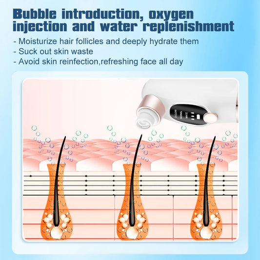 Electric Bubble Blackhead Remover Vacuum Suction Pore Cleaner Spot Acne Pimple Black Head Extractor Facial Cleaning Tools