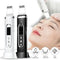 Ultrasonic Skin Scrubber Electric Facial Cleansing Pore Deep Cleanser Acne Blackhead Remover Peeling Shovel Device BeautyMachine