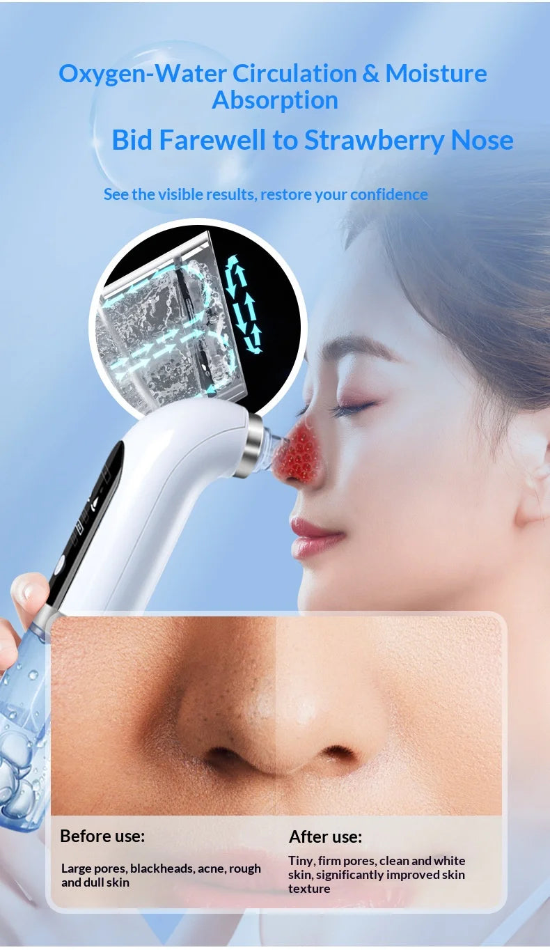Black Pore Vacuum Remover Electric Micro Bubble Cleanser USB Recharge Beauty Device Skin Care Instrument Tool