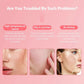 Facial Steamer Hot Cold Warm Mist Humidifier Face Deep Cleaning Vaporizer Nano Ionic Sprayer Salon Home Ozone Skin Moisturizer