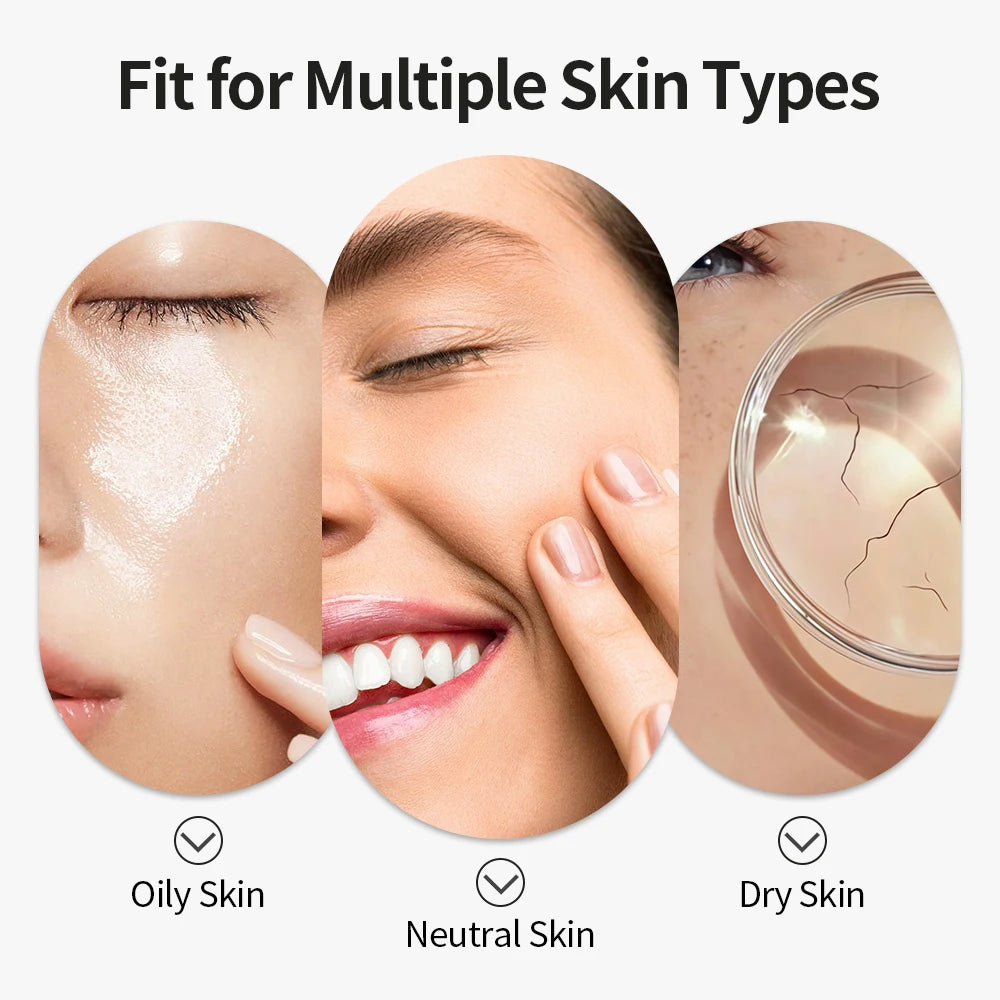 Blackhead Remover Facial Pore Cleaner 3 Suction Power Electric Pimple Acne Extractor Tool Face & Nose Whiteheads Vacuum Removal