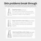 Blackhead Remover Facial Pore Cleaner 3 Suction Power Electric Pimple Acne Extractor Tool Face & Nose Whiteheads Vacuum Removal